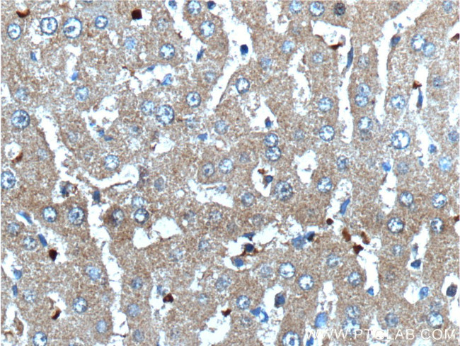 Angiogenin Antibody in Immunohistochemistry (Paraffin) (IHC (P))