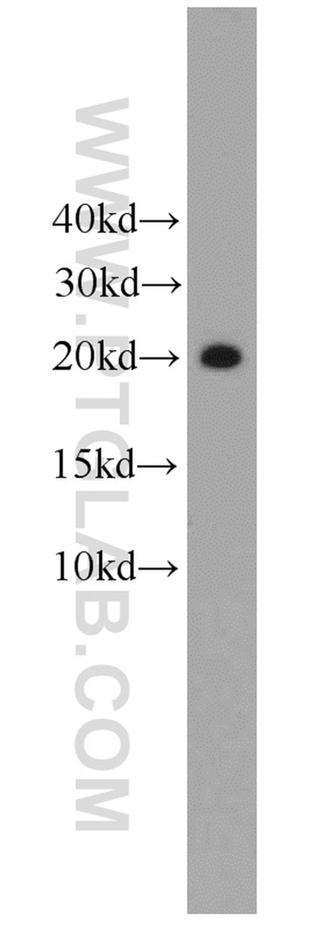 Angiogenin Antibody in Western Blot (WB)