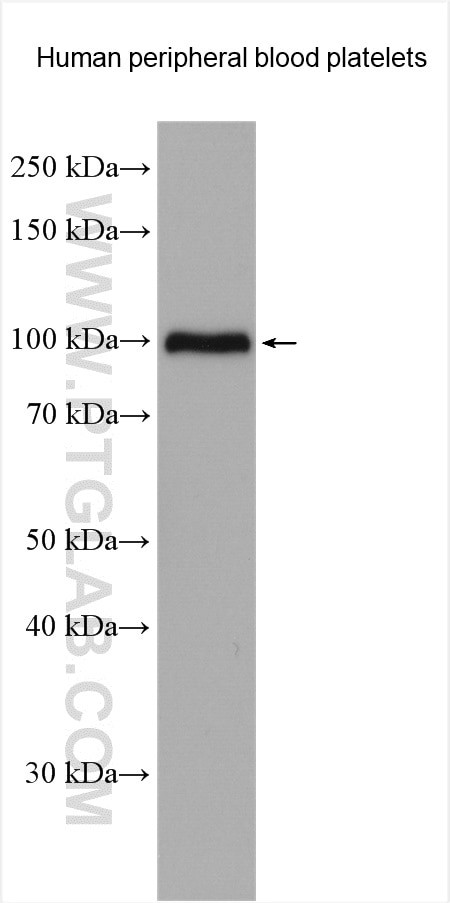 Integrin beta-3 Antibody in Western Blot (WB)