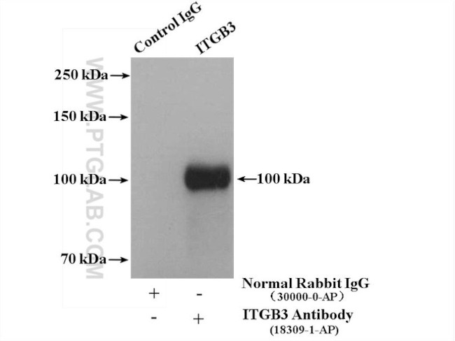 Integrin beta-3 Antibody in Immunoprecipitation (IP)