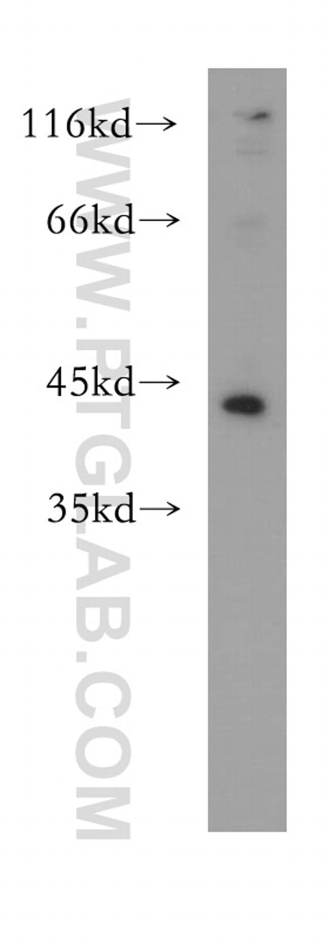 CEBPA Antibody in Western Blot (WB)