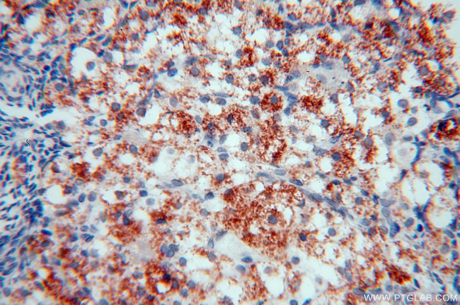 NHE8 Antibody in Immunohistochemistry (Paraffin) (IHC (P))