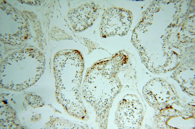 NHE8 Antibody in Immunohistochemistry (Paraffin) (IHC (P))