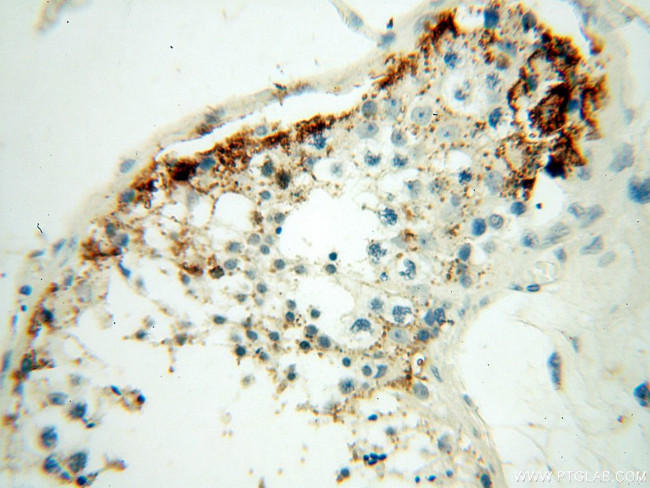 NHE8 Antibody in Immunohistochemistry (Paraffin) (IHC (P))