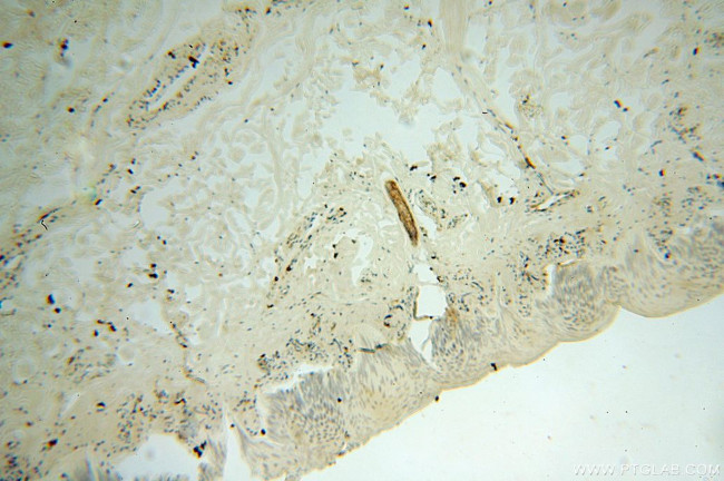 NHE8 Antibody in Immunohistochemistry (Paraffin) (IHC (P))