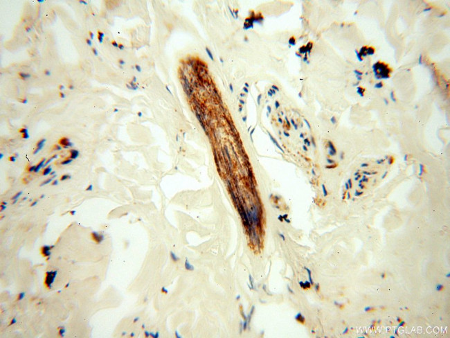 NHE8 Antibody in Immunohistochemistry (Paraffin) (IHC (P))