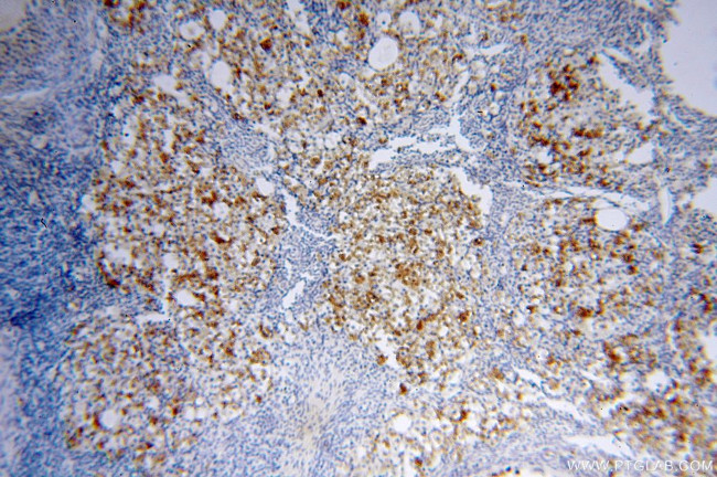 NHE8 Antibody in Immunohistochemistry (Paraffin) (IHC (P))