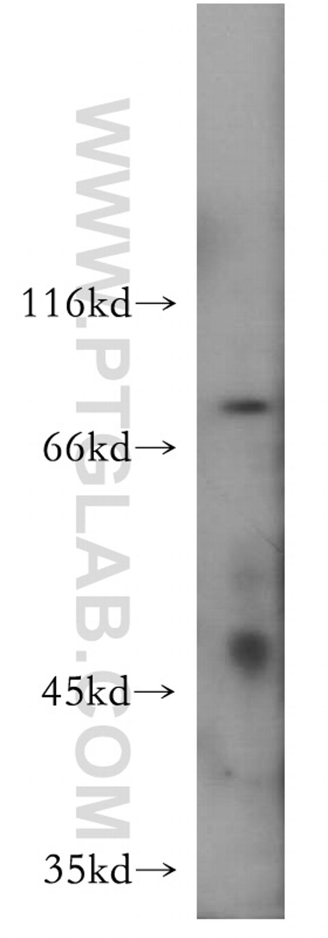 NHE8 Antibody in Western Blot (WB)