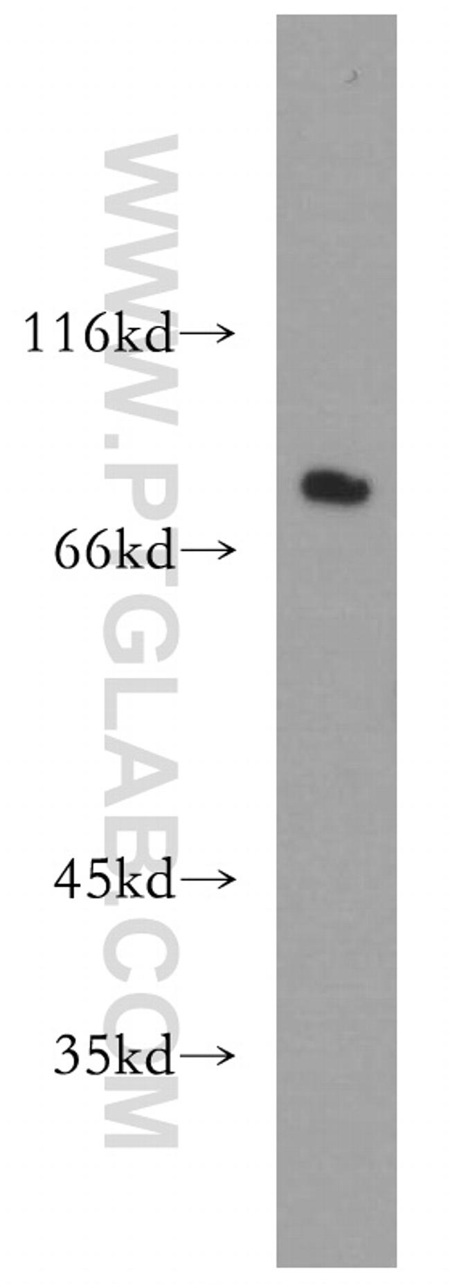 NHE8 Antibody in Western Blot (WB)