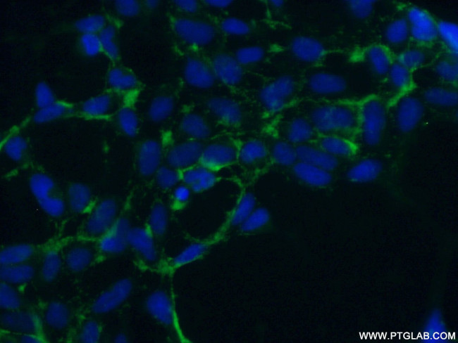 NHE8 Antibody in Immunocytochemistry (ICC/IF)