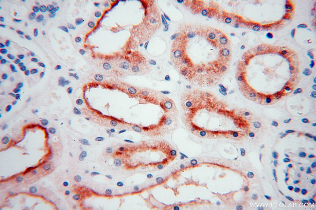 NHE8 Antibody in Immunohistochemistry (Paraffin) (IHC (P))