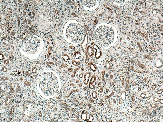 NHE8 Antibody in Immunohistochemistry (Paraffin) (IHC (P))