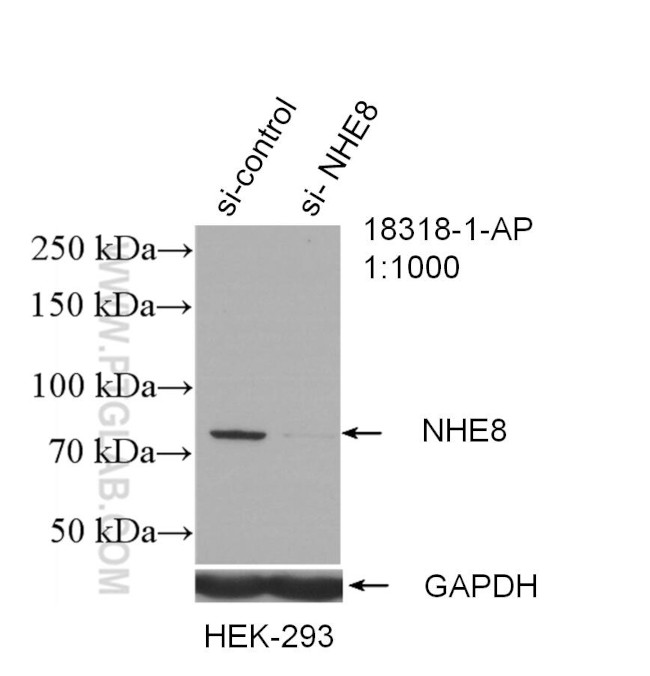 NHE8 Antibody in Western Blot (WB)