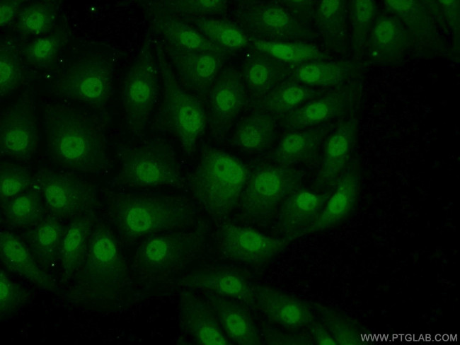 MAD1 Antibody in Immunocytochemistry (ICC/IF)