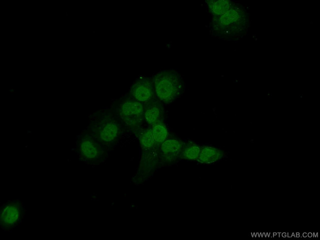 MAD1 Antibody in Immunocytochemistry (ICC/IF)