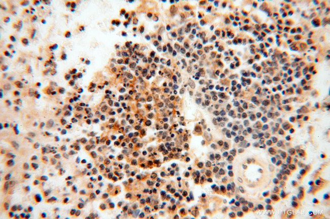 MAD1 Antibody in Immunohistochemistry (Paraffin) (IHC (P))