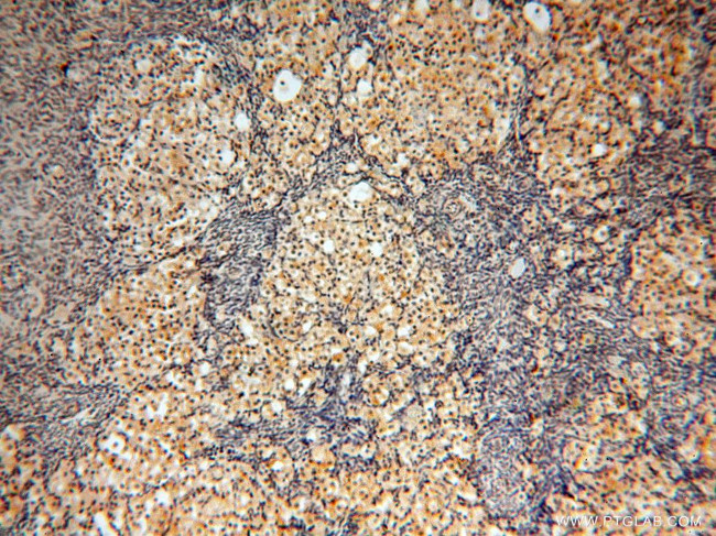 MAD1 Antibody in Immunohistochemistry (Paraffin) (IHC (P))