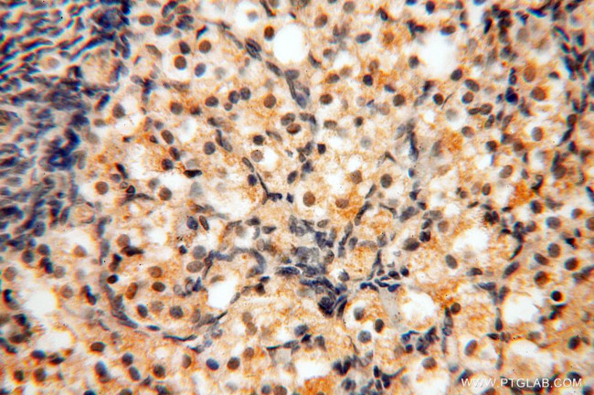 MAD1 Antibody in Immunohistochemistry (Paraffin) (IHC (P))