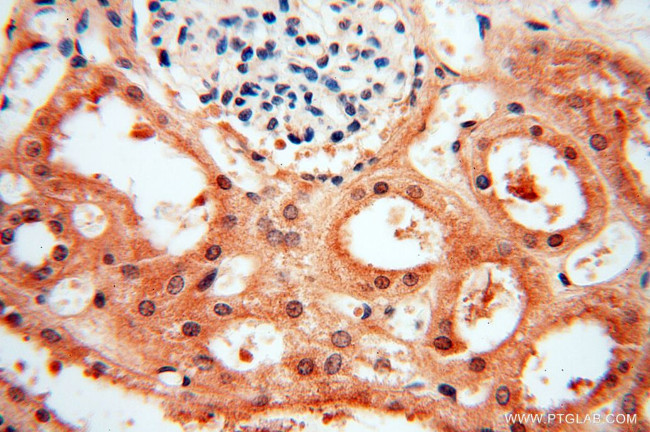 MAD1 Antibody in Immunohistochemistry (Paraffin) (IHC (P))