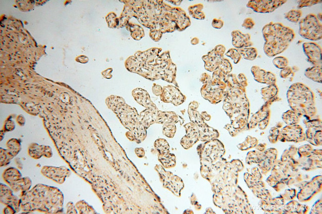 MAD1 Antibody in Immunohistochemistry (Paraffin) (IHC (P))