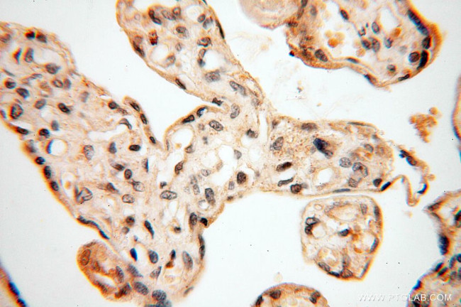 MAD1 Antibody in Immunohistochemistry (Paraffin) (IHC (P))