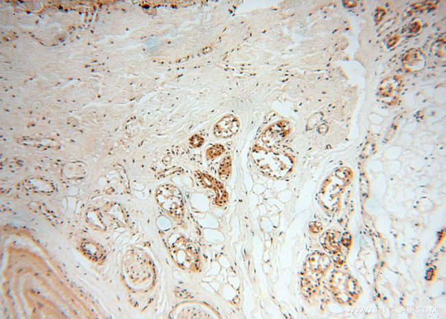 MAD1 Antibody in Immunohistochemistry (Paraffin) (IHC (P))