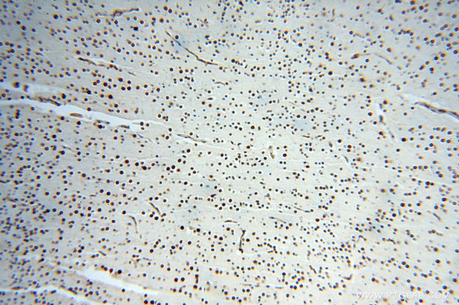 MAD1 Antibody in Immunohistochemistry (Paraffin) (IHC (P))