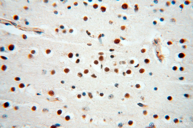 MAD1 Antibody in Immunohistochemistry (Paraffin) (IHC (P))