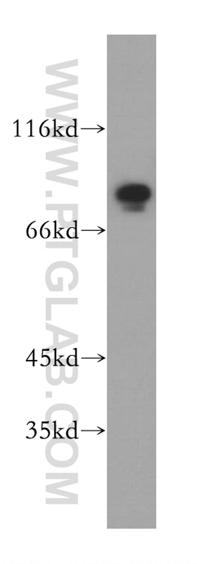 MAD1 Antibody in Western Blot (WB)