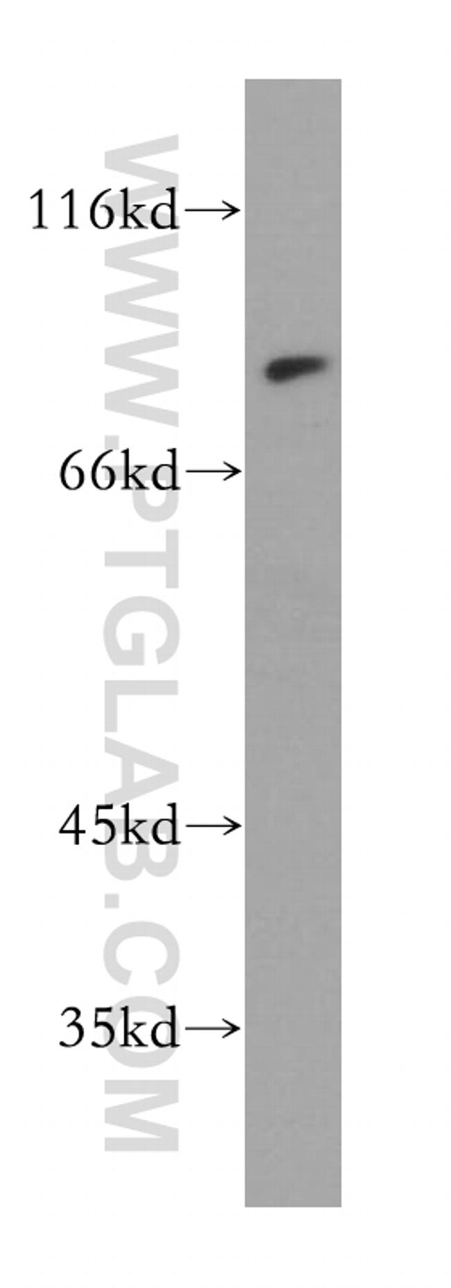 MAD1 Antibody in Western Blot (WB)