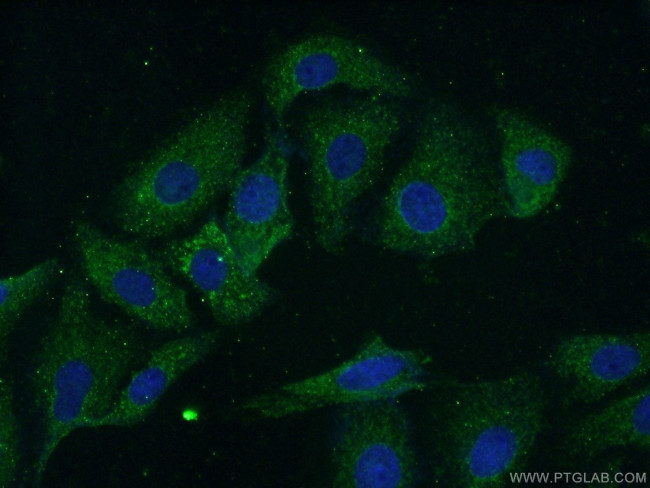 DEAF1 Antibody in Immunocytochemistry (ICC/IF)