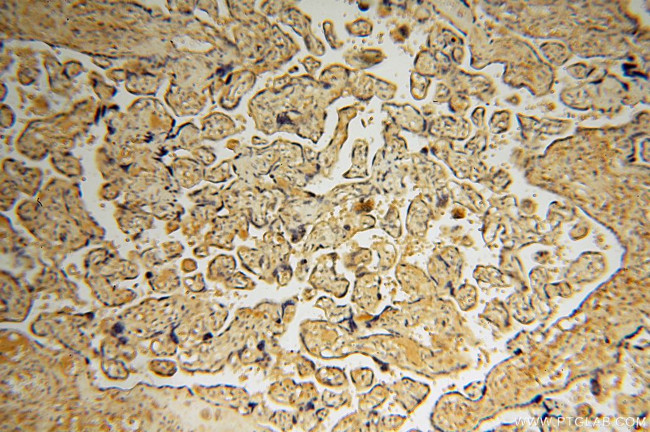 DEAF1 Antibody in Immunohistochemistry (Paraffin) (IHC (P))