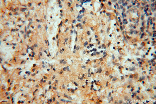 DEAF1 Antibody in Immunohistochemistry (Paraffin) (IHC (P))