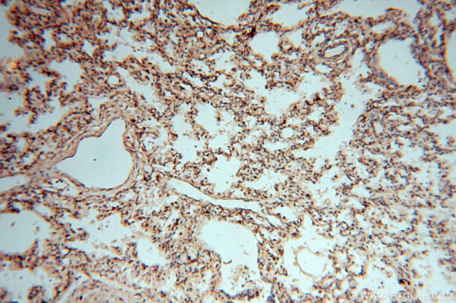 DEAF1 Antibody in Immunohistochemistry (Paraffin) (IHC (P))