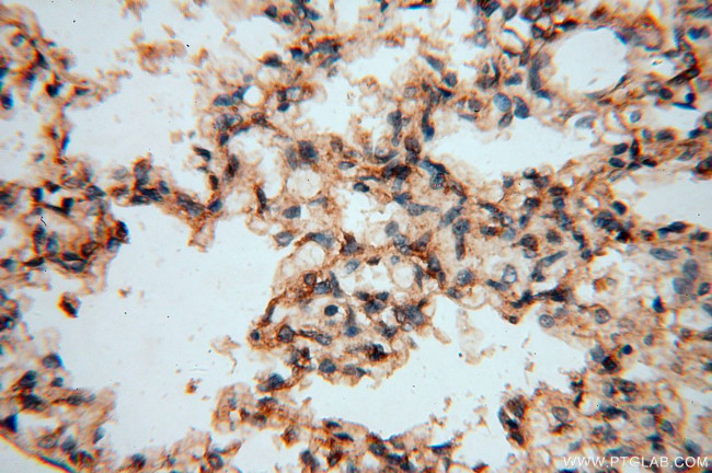 DEAF1 Antibody in Immunohistochemistry (Paraffin) (IHC (P))