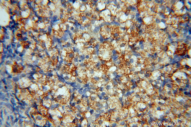 DEAF1 Antibody in Immunohistochemistry (Paraffin) (IHC (P))