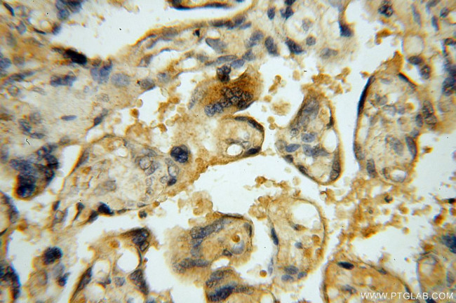 DEAF1 Antibody in Immunohistochemistry (Paraffin) (IHC (P))