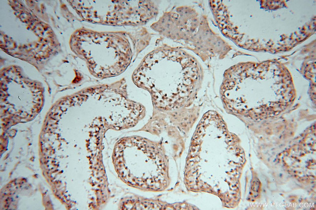 DEAF1 Antibody in Immunohistochemistry (Paraffin) (IHC (P))