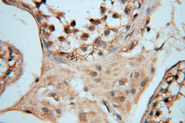 DEAF1 Antibody in Immunohistochemistry (Paraffin) (IHC (P))