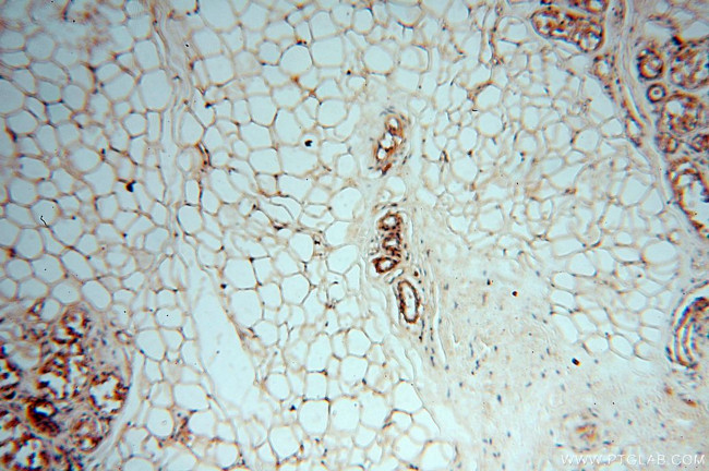 DEAF1 Antibody in Immunohistochemistry (Paraffin) (IHC (P))