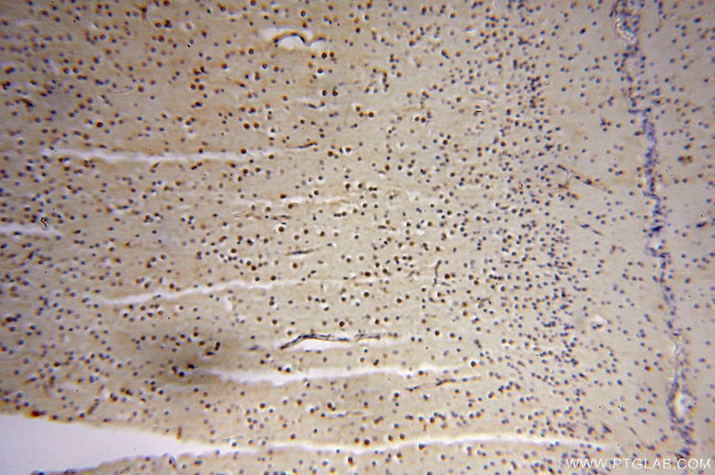 DEAF1 Antibody in Immunohistochemistry (Paraffin) (IHC (P))