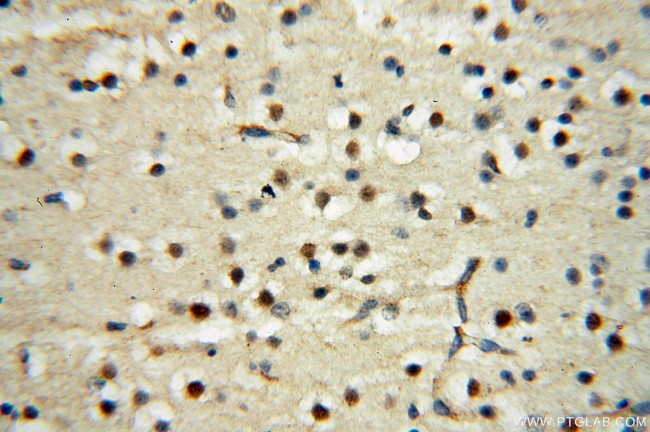 DEAF1 Antibody in Immunohistochemistry (Paraffin) (IHC (P))