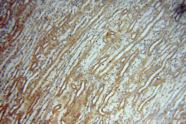 DEAF1 Antibody in Immunohistochemistry (Paraffin) (IHC (P))