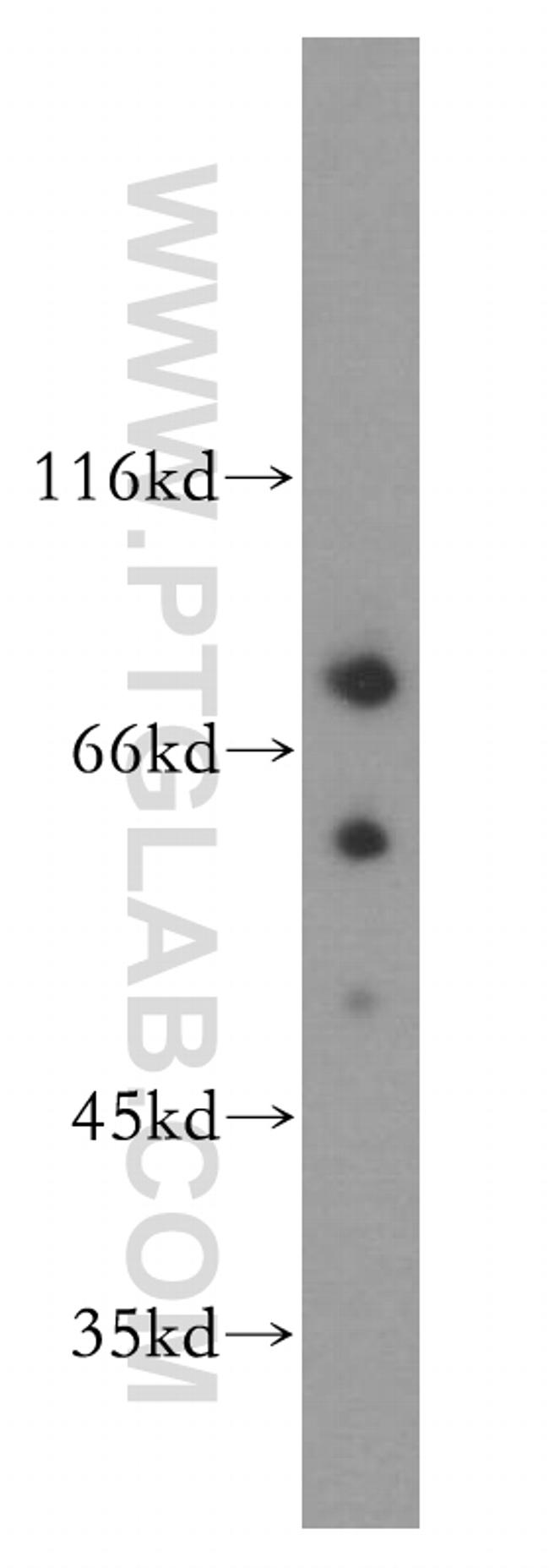 DEAF1 Antibody in Western Blot (WB)