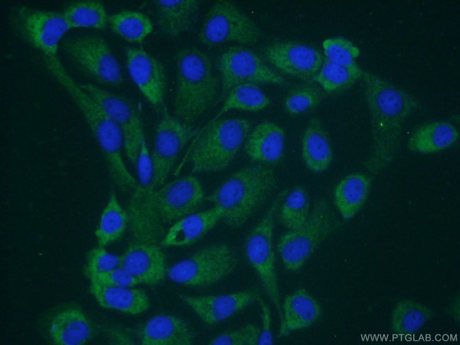 SSH3 Antibody in Immunocytochemistry (ICC/IF)