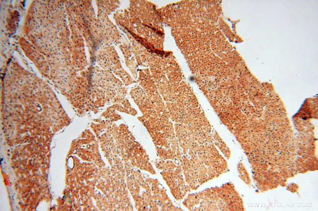 SSH3 Antibody in Immunohistochemistry (Paraffin) (IHC (P))