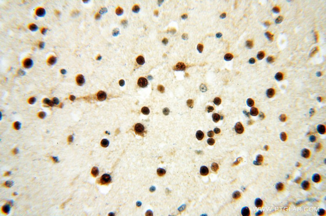 SSH3 Antibody in Immunohistochemistry (Paraffin) (IHC (P))