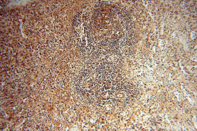 SSH3 Antibody in Immunohistochemistry (Paraffin) (IHC (P))