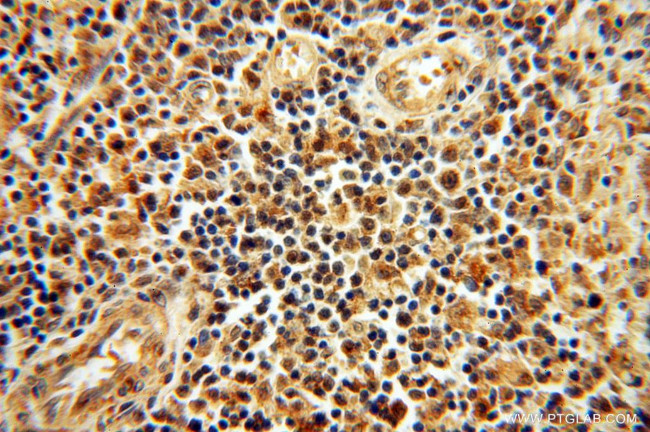 SSH3 Antibody in Immunohistochemistry (Paraffin) (IHC (P))