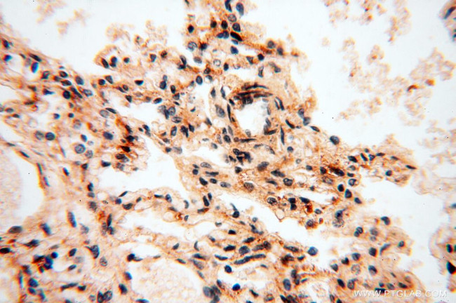 SSH3 Antibody in Immunohistochemistry (Paraffin) (IHC (P))